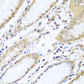 WDR48 Polyclonal Antibody