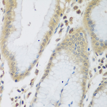 ENPEP Rabbit Polyclonal Antibody