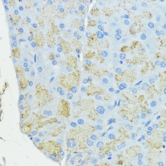 SOD3 Polyclonal Antibody