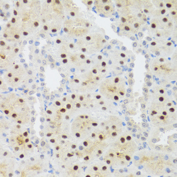 STAT4 Rabbit Polyclonal Antibody