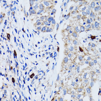 LC3B Polyclonal Antibody