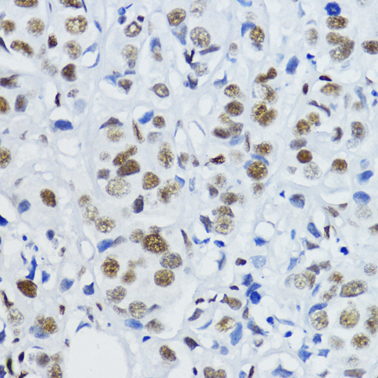Histone H3K27AC antibody