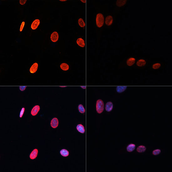 Acetyl-Histone H3-K56 pAb