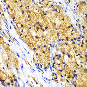 CAPG Polyclonal Antibody