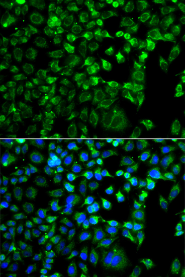 ZAK Rabbit Polyclonal Antibody