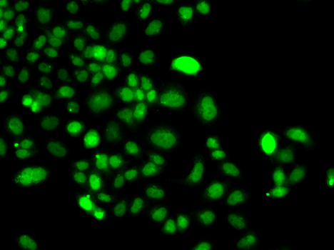 PIP4K2A Rabbit Polyclonal Antibody