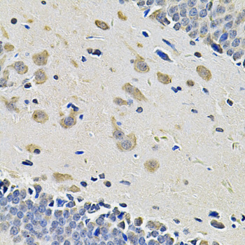 ITGA2 Polyclonal Antibody