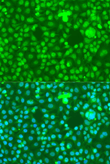 NOTCH1 Polyclonal Antibody