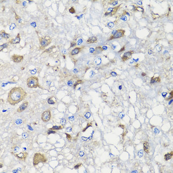 BCS1L Polyclonal Antibody