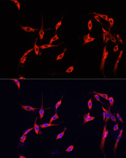 SMAD2 Polyclonal Antibody