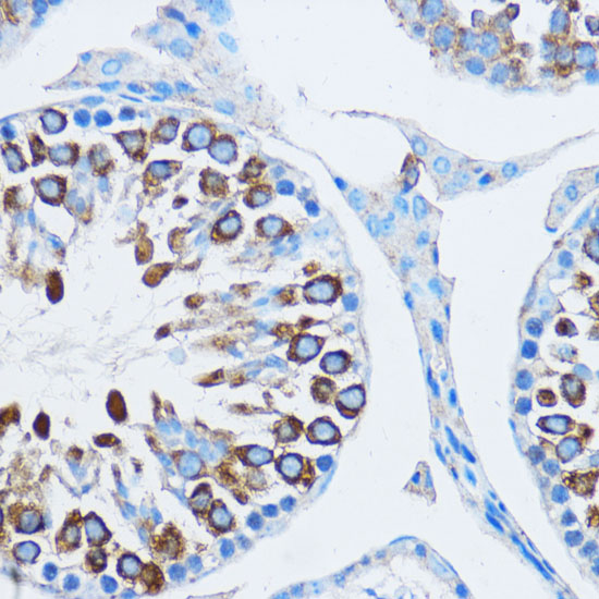 YBX1 Polyclonal Antibody
