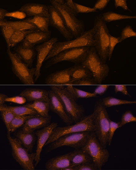 MAP2K3 Polyclonal Antibody