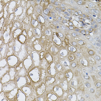 UBE2A Rabbit Polyclonal Antibody