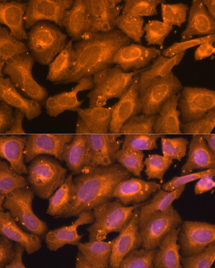 SQSTM1 / p62 Polyclonal Antibody