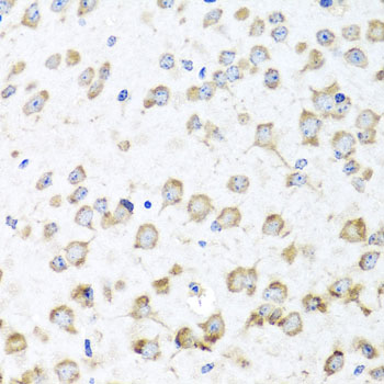 RPL36 Rabbit Polyclonal Antibody