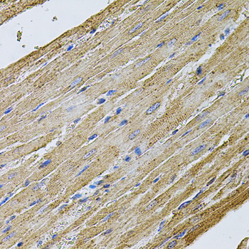 CDH16 Rabbit Polyclonal Antibody