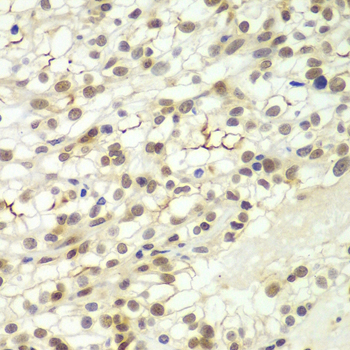 LHX4 Polyclonal Antibody