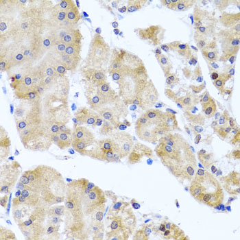 CETN3 Rabbit Polyclonal Antibody