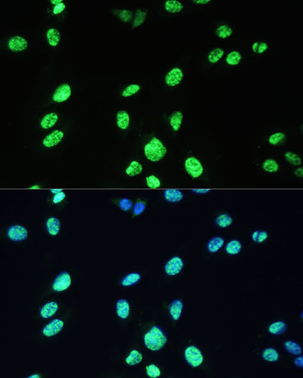DDX39B Rabbit Polyclonal Antibody