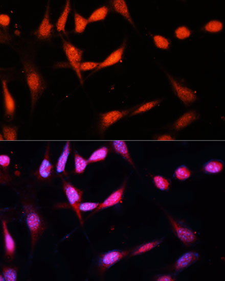 METTL3 Polyclonal Antibody