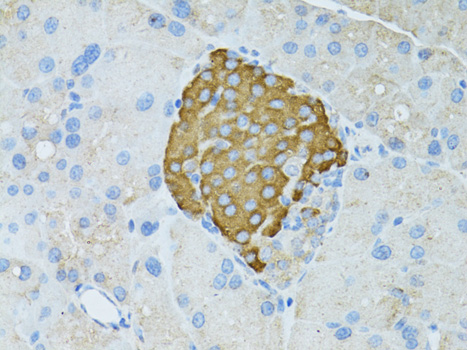 TEFM Polyclonal Antibody