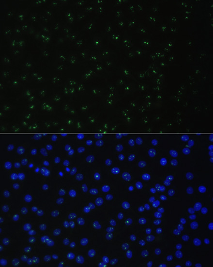DDX50 Rabbit Polyclonal Antibody