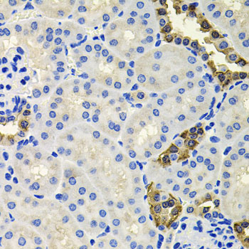 CALB2 Rabbit Polyclonal Antibody