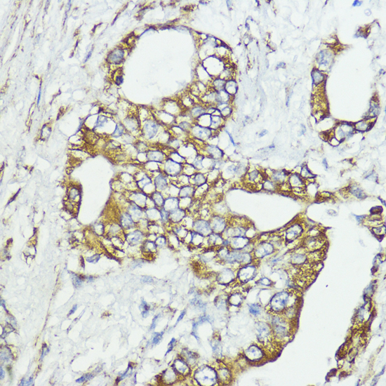 SOCS6 Rabbit Polyclonal Antibody