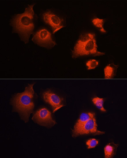 MCL1 antibody