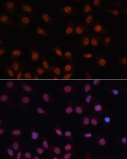 CDKN2A Antibody