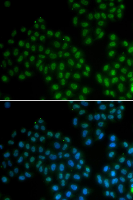 SOX2 antibody