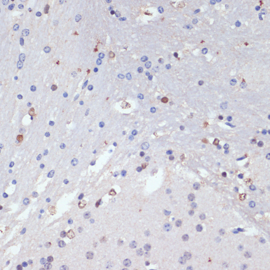 SOX2 antibody