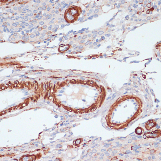 DES antibody