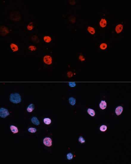 HDAC3 Antibody