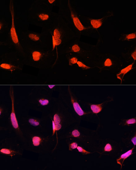 ZNF264 Polyclonal Antibody