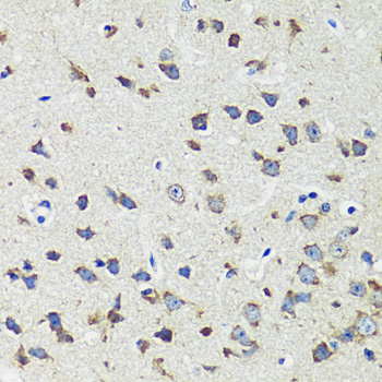 CCDC124 Polyclonal Antibody