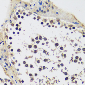 CCDC59 Polyclonal Antibody