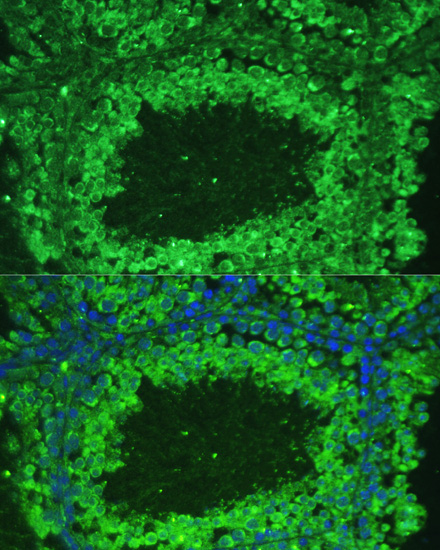 ASZ1 Polyclonal Antibody