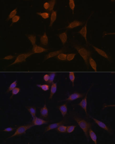 NDUFA5 Polyclonal Antibody