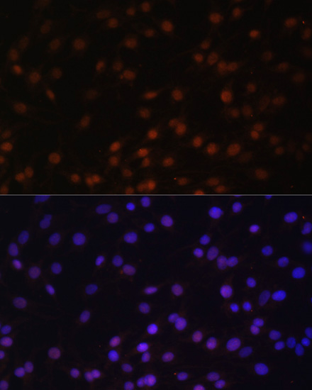 ZNF177 Polyclonal Antibody