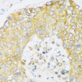 ERLIN1 Polyclonal Antibody