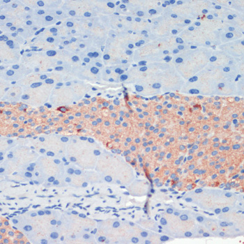 KIF5B Polyclonal Antibody