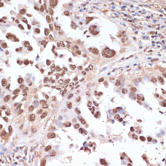 ITCH Polyclonal Antibody
