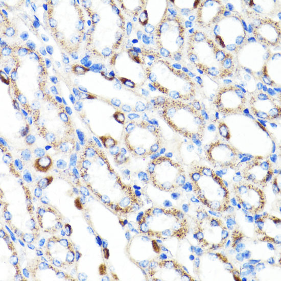 RNF149 Polyclonal Antibody