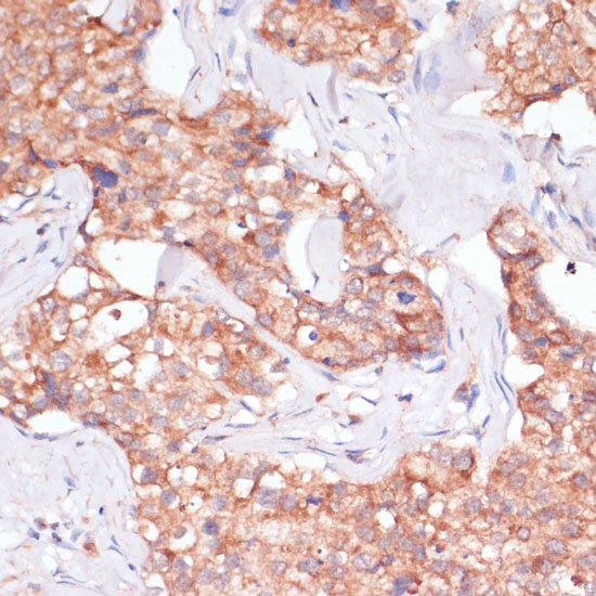 TIMM8B Polyclonal Antibody