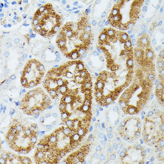 MAP3K1 Polyclonal Antibody