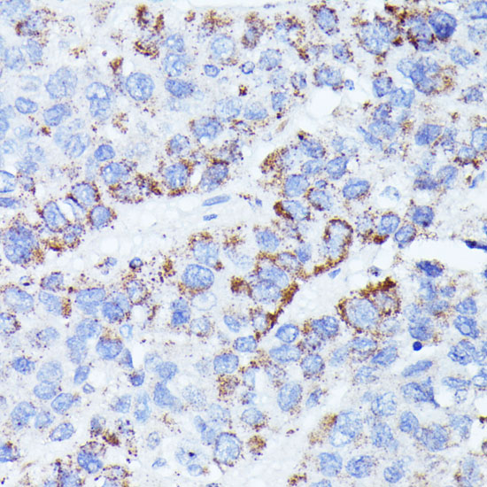 CCDC6 Polyclonal Antibody