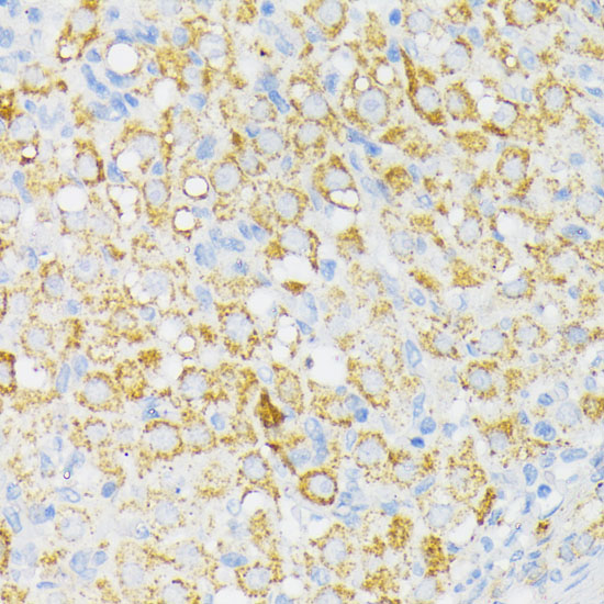 USP33 Polyclonal Antibody
