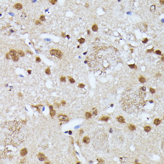 KIAA1429 Polyclonal Antibody