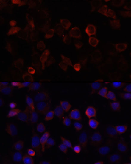 S100A4 antibody